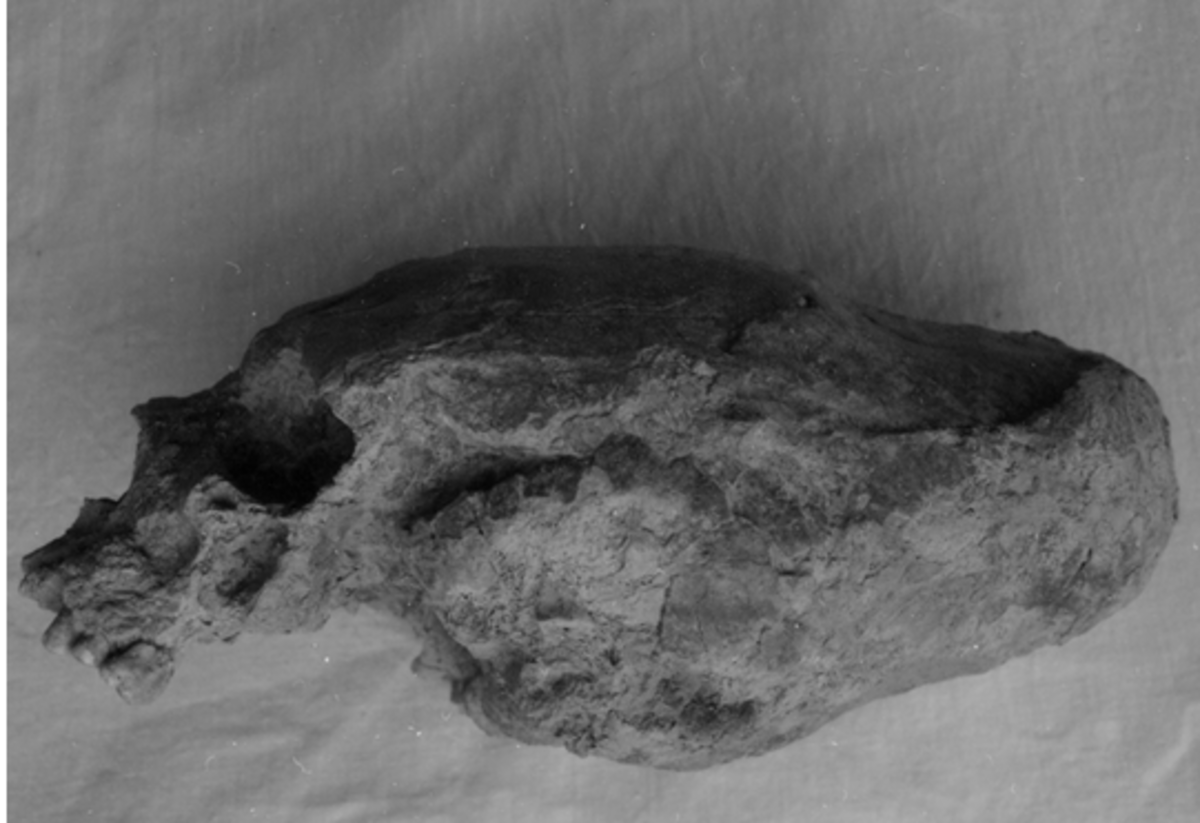  Black and white photo of an elongated skull believed to be from a Viking warrior.